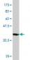 SMARCD3 Antibody (monoclonal) (M04)
