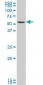 SMARCD3 Antibody (monoclonal) (M04)