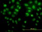 SNAI2 Antibody (monoclonal) (M01)