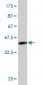 SNAI2 Antibody (monoclonal) (M01)
