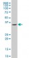 SNAI2 Antibody (monoclonal) (M01)