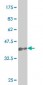 SNAI2 Antibody (monoclonal) (M03)