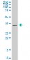 SNAI2 Antibody (monoclonal) (M03)