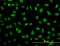 SNAI2 Antibody (monoclonal) (M04)