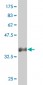 SNAI2 Antibody (monoclonal) (M04)