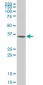 SNAI2 Antibody (monoclonal) (M04)