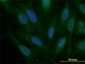 SNAI2 Antibody (monoclonal) (M05)