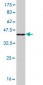 SNCG Antibody (monoclonal) (M01)
