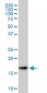 SNCG Antibody (monoclonal) (M01)