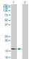 SNCG Antibody (monoclonal) (M01)