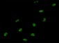 SNRPA Antibody (monoclonal) (M01)