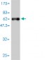 SNRPA Antibody (monoclonal) (M01)