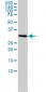 SNRPA Antibody (monoclonal) (M01)