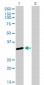 SNRPA Antibody (monoclonal) (M01)