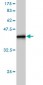 SNX1 Antibody (monoclonal) (M01)