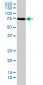 SNX1 Antibody (monoclonal) (M01)