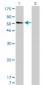 SNX1 Antibody (monoclonal) (M01)