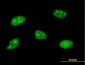 SOCS3 Antibody (monoclonal) (M02)