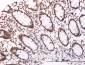 SOCS3 Antibody (monoclonal) (M02)