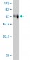 SOCS4 Antibody (monoclonal) (M01)