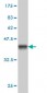 SORD Antibody (monoclonal) (M01)