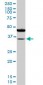 SORD Antibody (monoclonal) (M01)