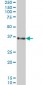 SORD Antibody (monoclonal) (M01)