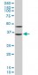 SORD Antibody (monoclonal) (M01)