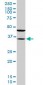SORD Antibody (monoclonal) (M01)