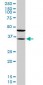 SORD Antibody (monoclonal) (M01)