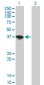 SORD Antibody (monoclonal) (M01)