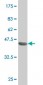 SOX30 Antibody (monoclonal) (M02)