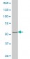 SOX30 Antibody (monoclonal) (M02)