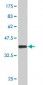 SOX8 Antibody (monoclonal) (M03)