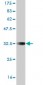 SP7 Antibody (monoclonal) (M01)