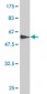 SPARC Antibody (monoclonal) (M02)