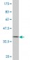 SPAST Antibody (monoclonal) (M02)