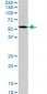 SPAST Antibody (monoclonal) (M02)