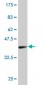 SPI1 Antibody (monoclonal) (M02)