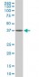 SPP1 Antibody (monoclonal) (M06)