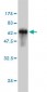 SPRY2 Antibody (monoclonal) (M01)