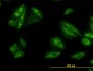 SQSTM1 Antibody (monoclonal) (M01)