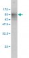 SQSTM1 Antibody (monoclonal) (M01)