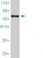SSB Antibody (monoclonal) (M01)
