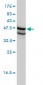 SSB Antibody (monoclonal) (M01)