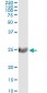 ST6GAL1 Antibody (monoclonal) (M01)