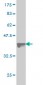 ST6GAL1 Antibody (monoclonal) (M01)