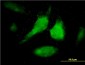 STAT1 Antibody (monoclonal) (M01)