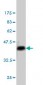 STAT1 Antibody (monoclonal) (M01)
