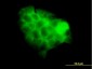 STAT2 Antibody (monoclonal) (M01)